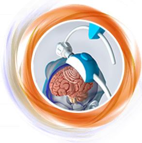 Transcranial Magnetic Stimulation (TMS)